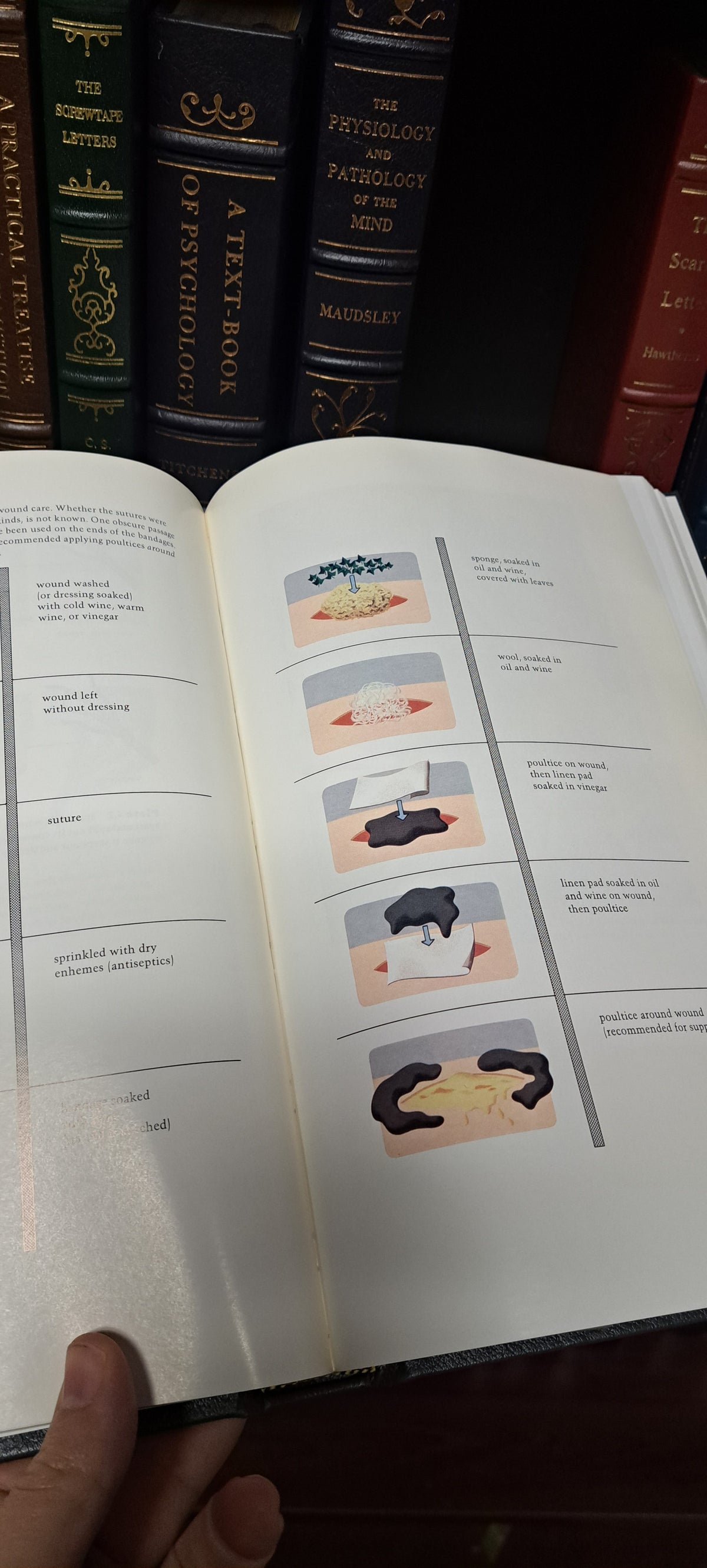 The Healing Hand by Majno