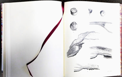 Atlas of the Pathological Anatomy of the Eyeball by Pagenstecher and Genth