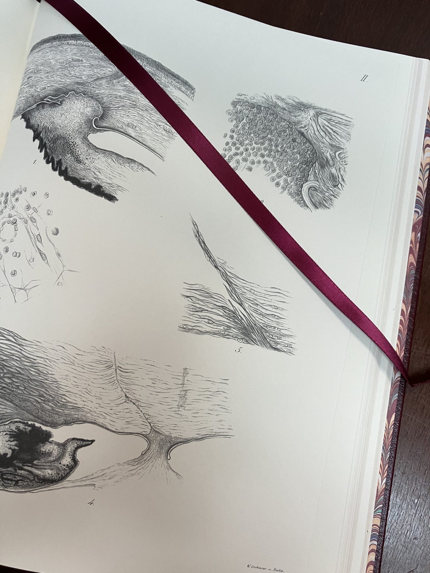 Atlas of the Pathological Anatomy of the Eyeball by Pagenstecher and Genth