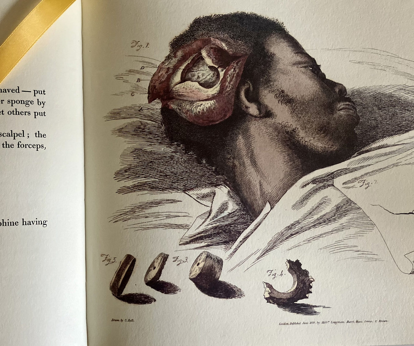 Illustrations of the Great Operations of Surgery by Charles Bell