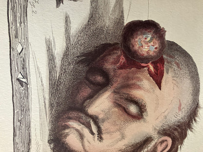 Illustrations of the Great Operations of Surgery by Charles Bell